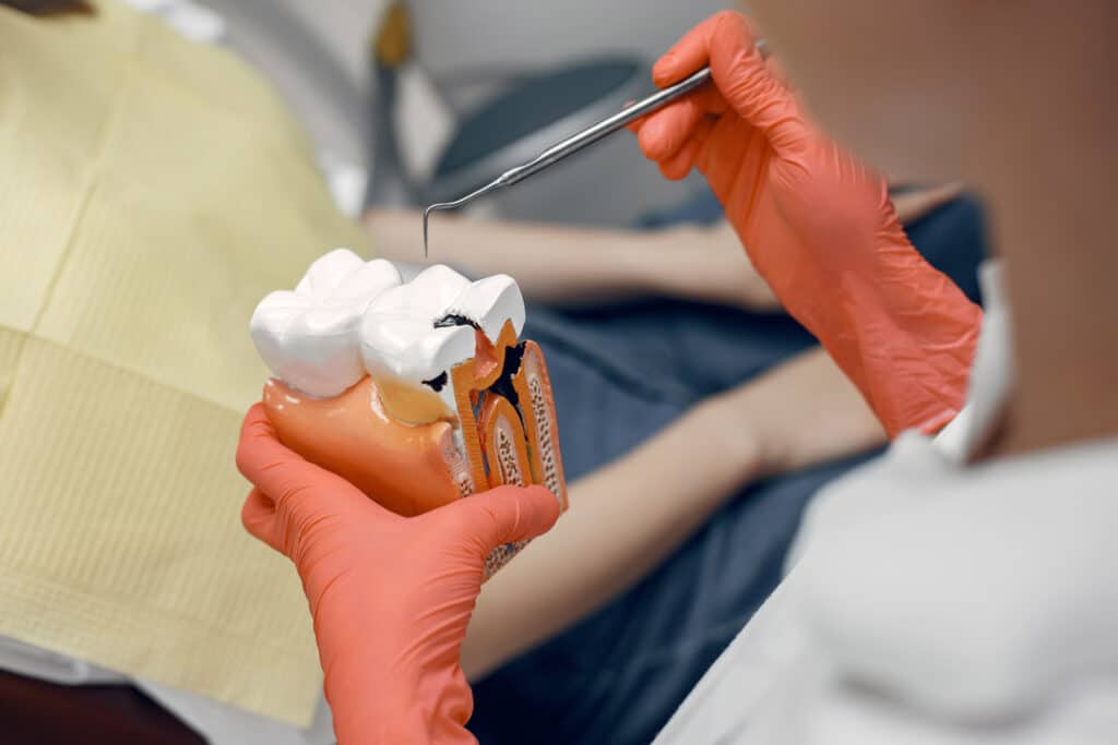 Modelo de endodoncia en Clínica Dental Augusto Leguía