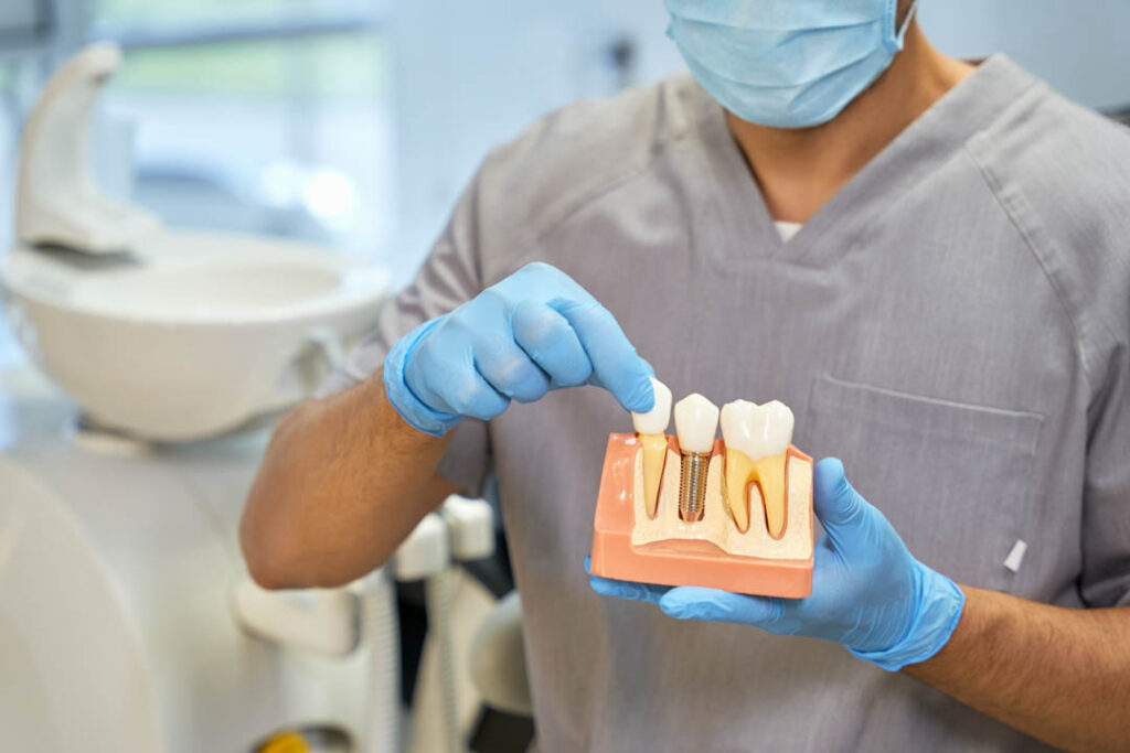 Especialista dental demostrando la anatomía de un implante dental en la Clínica Dental Augusto Leguía